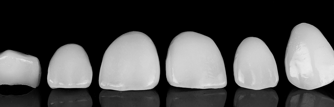 審美治療｜鹿沼台こばやかわ歯科