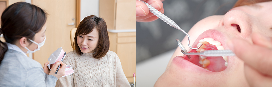 定期検診｜鹿沼台こばやかわ歯科