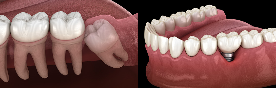 歯科口腔外科｜鹿沼台こばやかわ歯科